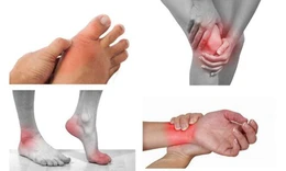 điều trị